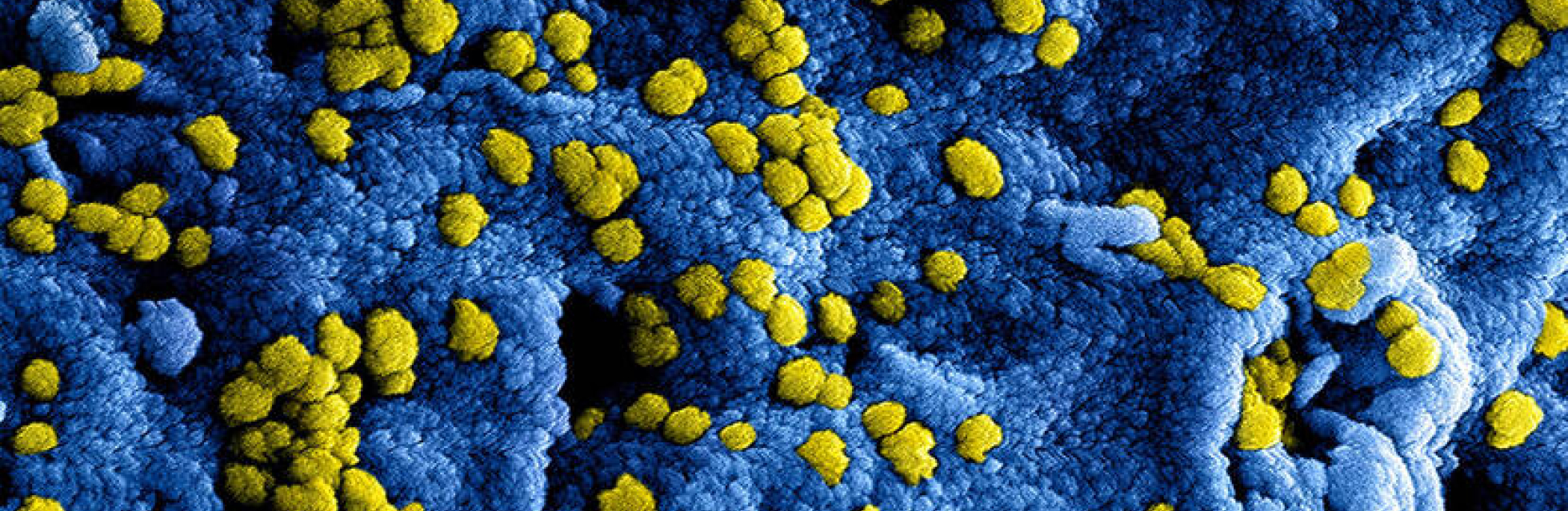 Corona Virus Covid 19 Denhaag Com